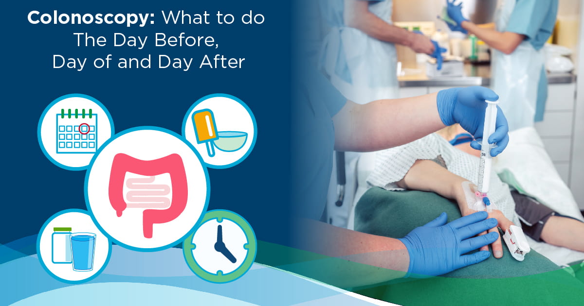 Colonoscopy Guide: What To Do The Day Before, Day Of, Day After | Mercy ...